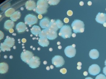 Close-up of white bacterial growths of varying sizes on an agar plate.